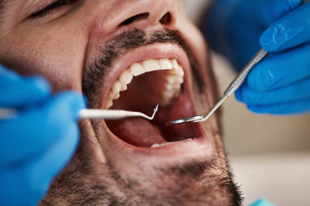 Best Emergency Tooth Extraction in Williston Park, NY